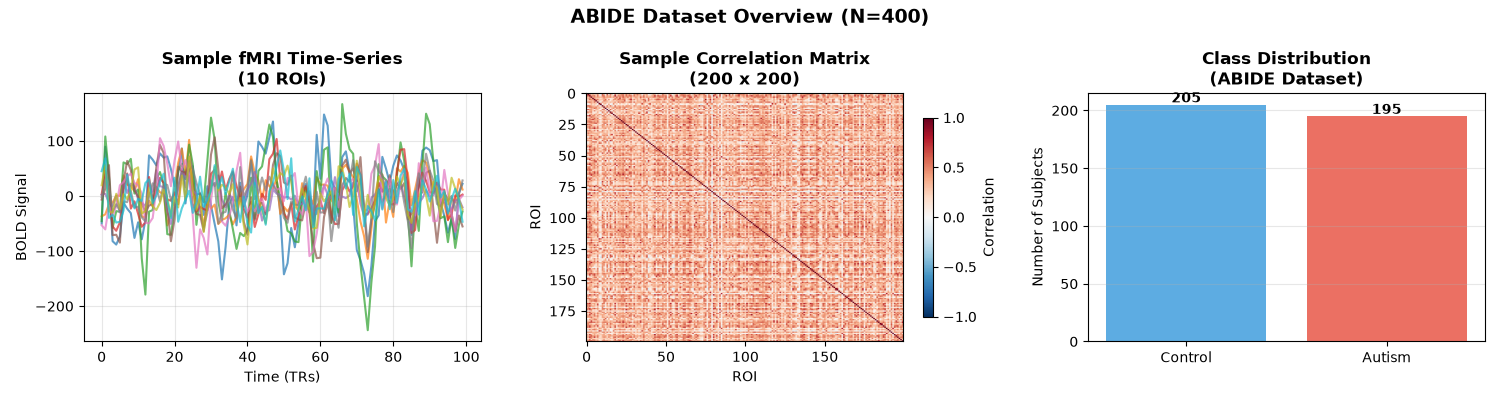ABIDE Dataset Overview (N=400), Sample fMRI Time-Series (10 ROIs), Sample Correlation Matrix (200 x 200), Class Distribution (ABIDE Dataset)